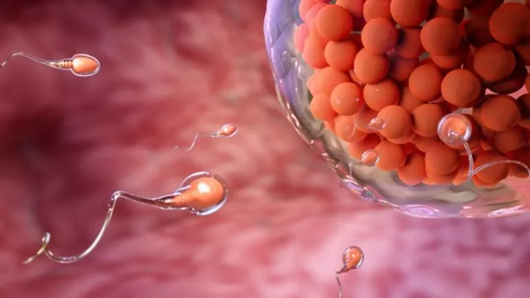 Menide “Sıfır Sperm”: Azospermi ve türleri